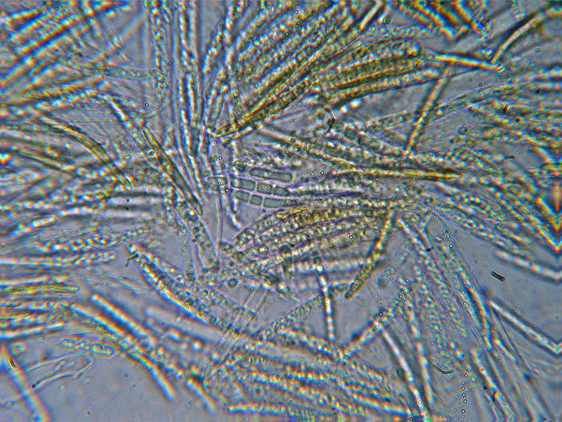 Dasyscyphus sulfureus